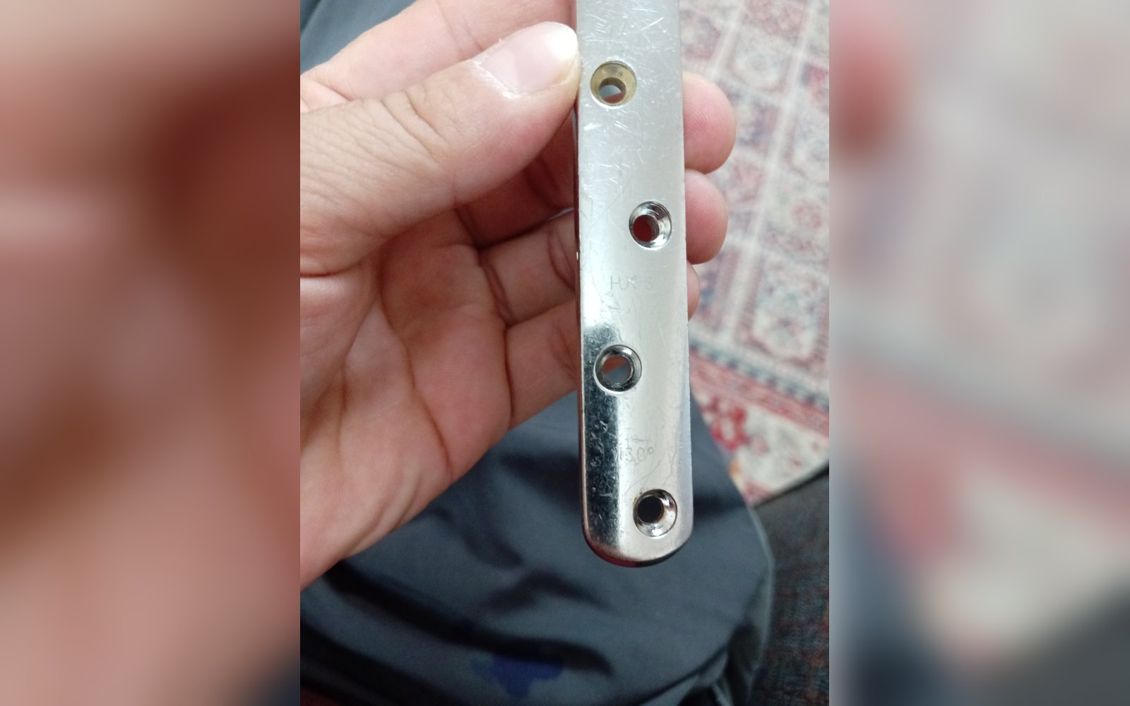 صفيحة جبر عظم