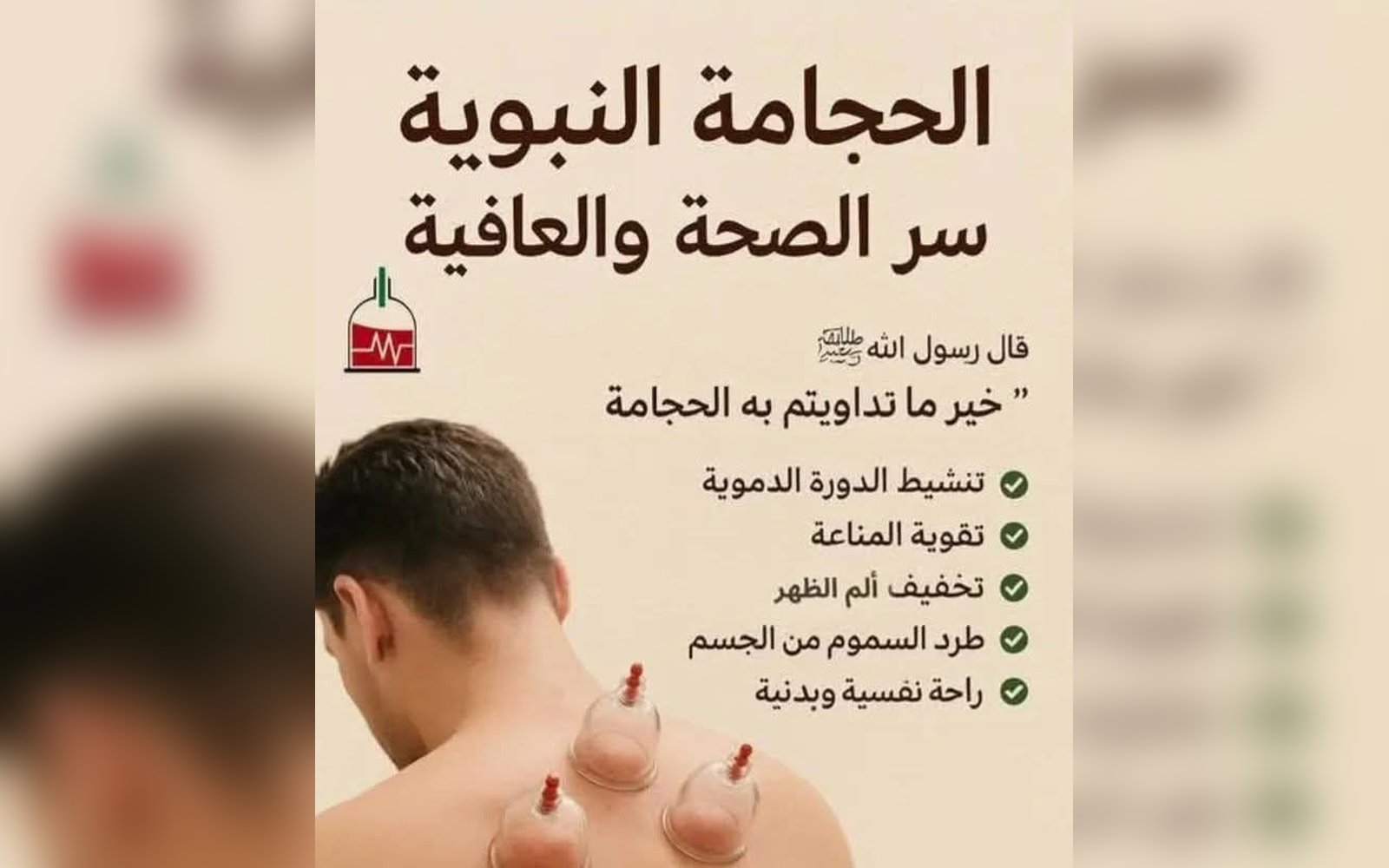 الحجامة